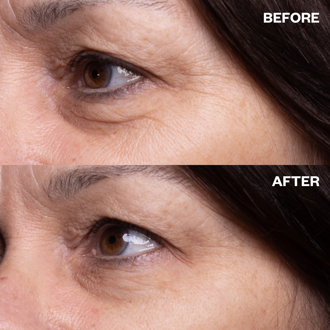 Re-usable Silicone Eye Wrinkle Patches