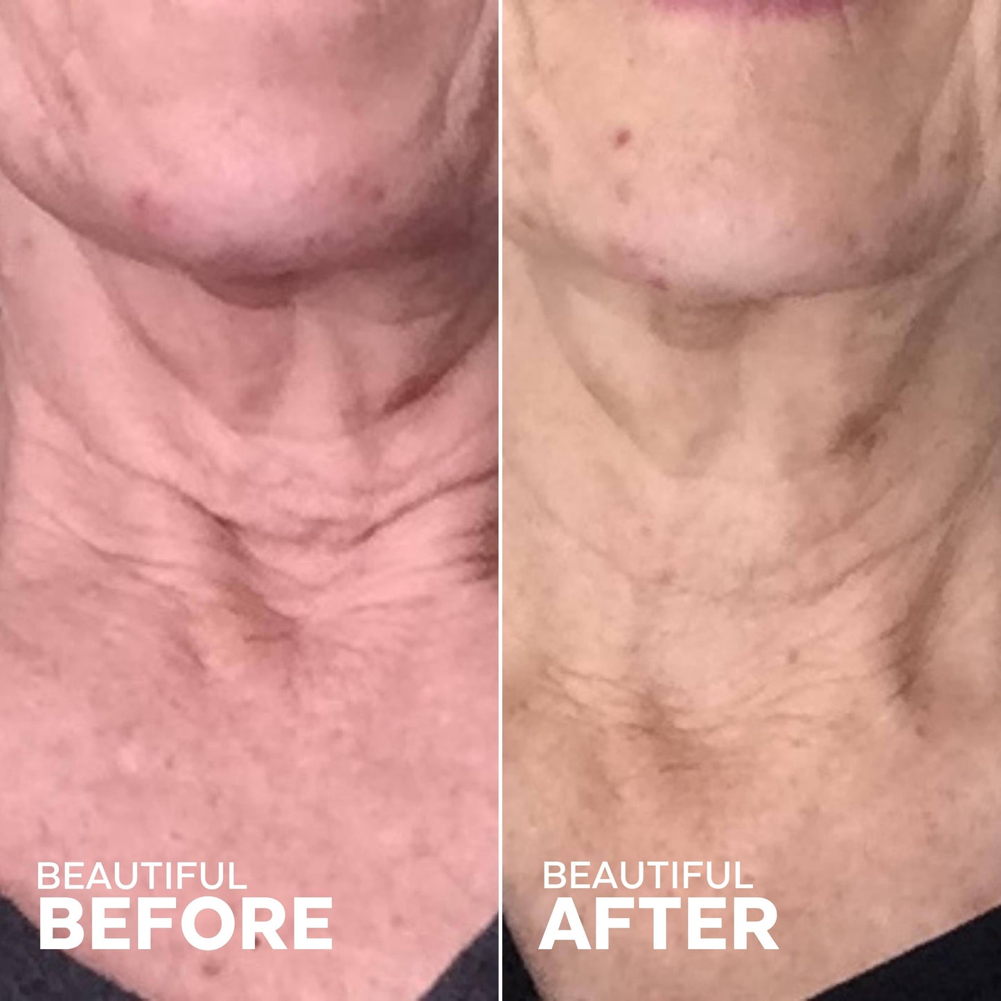 Three Ships Beauty Firm Believer Goji Stem Cell + Pomegranate Smoothing Neck + Face Cream