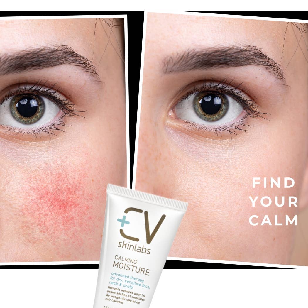 Calming Moisture for Face-Neck-and-Scalp