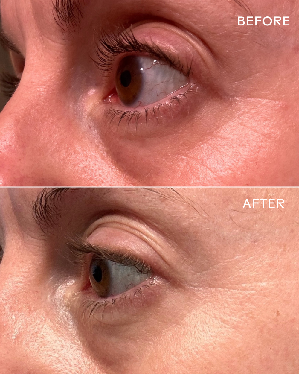 Three Ships EyeHero™ Bio-Retinol Smoothing Eye Cream