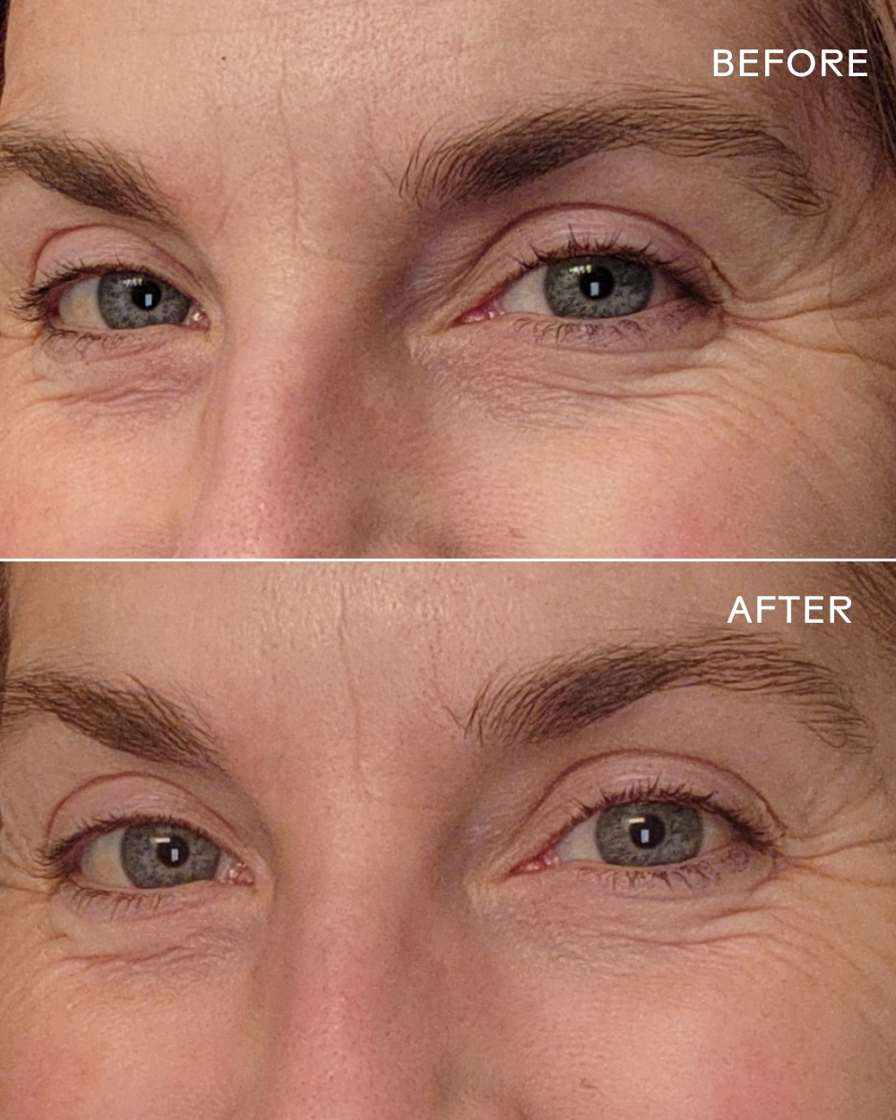 Three Ships EyeHero™ Bio-Retinol Smoothing Eye Cream